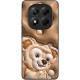 TPU+PC чохол Prisma Fluffie для Xiaomi Redmi Note 14 Pro 4G Dream