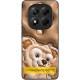 TPU+PC чохол Prisma Fluffie для Xiaomi Redmi Note 14 4G (Int. version) Dream